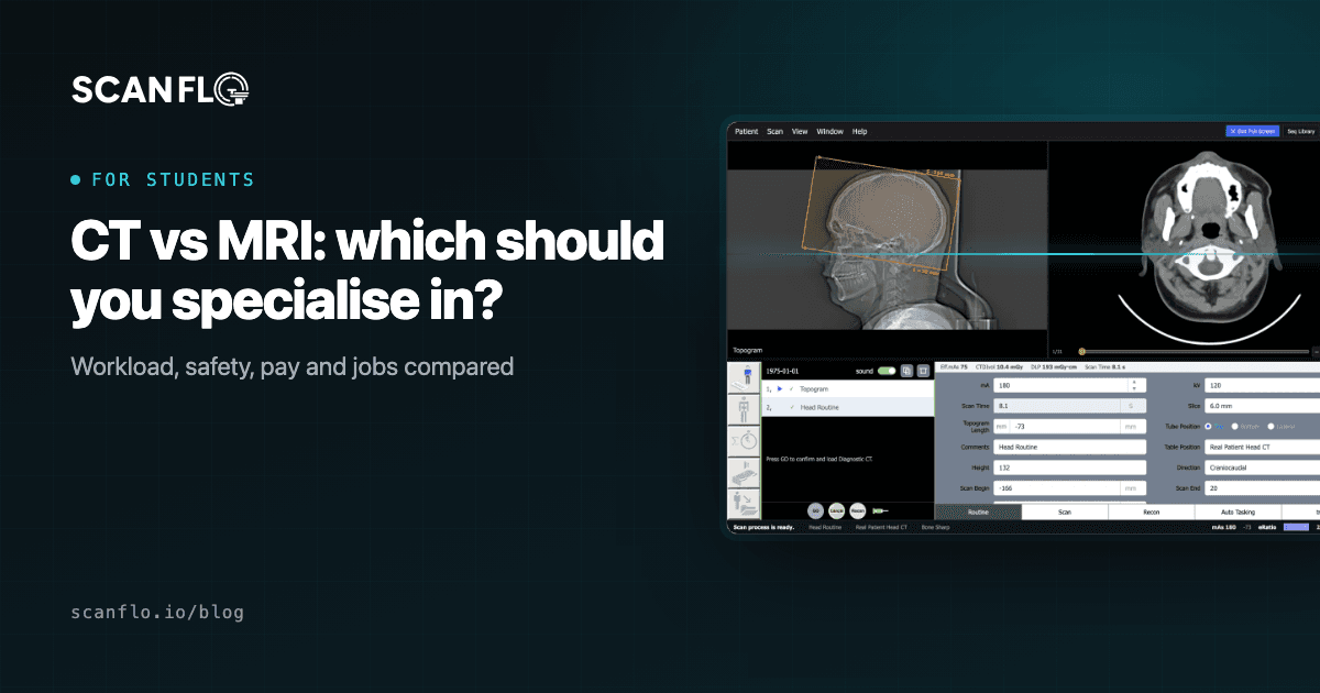 ScanFlo CT and MRI consoles side by side with the title 'CT vs MRI: which should you specialise in?'