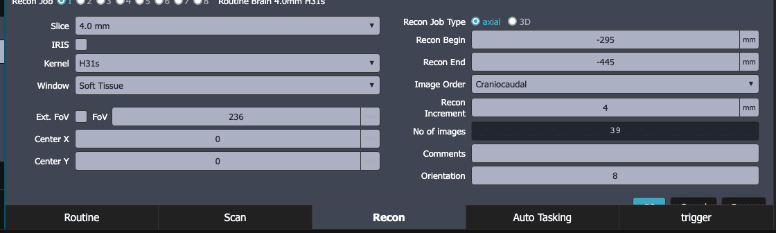 ScanFlo CT console Recon tab for a routine brain job: slice 4.0 mm, kernel H31s, window Soft Tissue, FoV 236 mm, recon begin −295 mm and end −445 mm, increment 4 mm, 39 images.