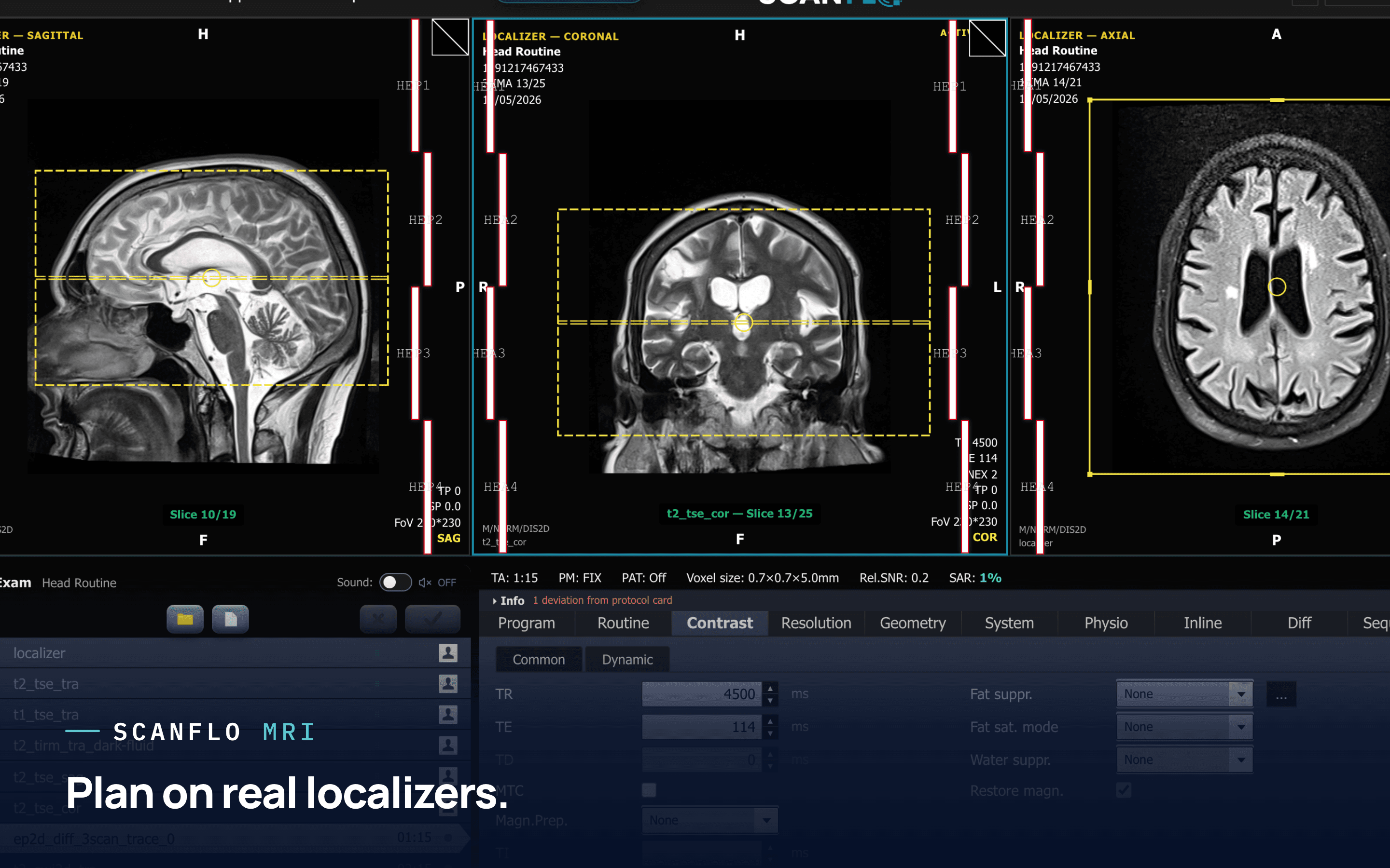 ScanFlo product loop: MRI slice planning and a TR and TE contrast change, CT dose and a 3D bone render, PET-CT bed planning and a fused study, 3D anatomy, and RadPath disease cases