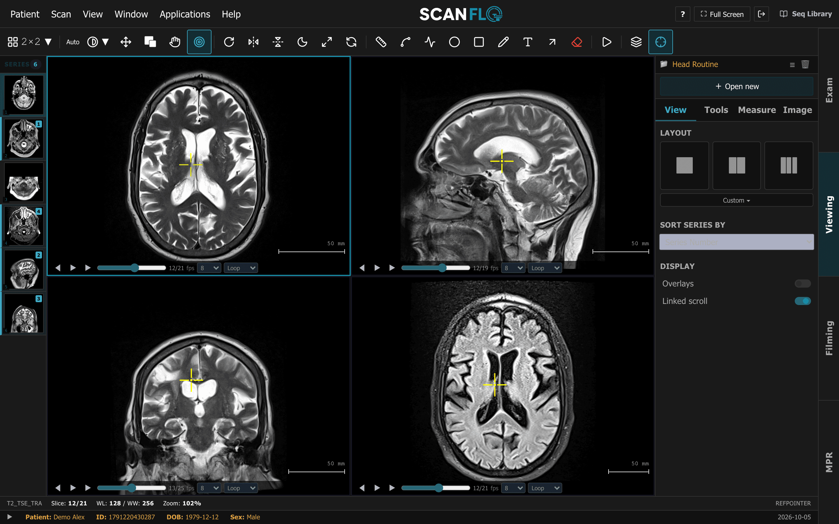 ScanFlo MRI viewing workspace with a brain series in four linked panes