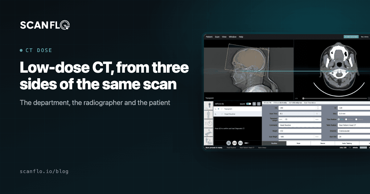 ScanFlo CT console with a topogram beside the title 'Low-dose CT, from three sides of the same scan'