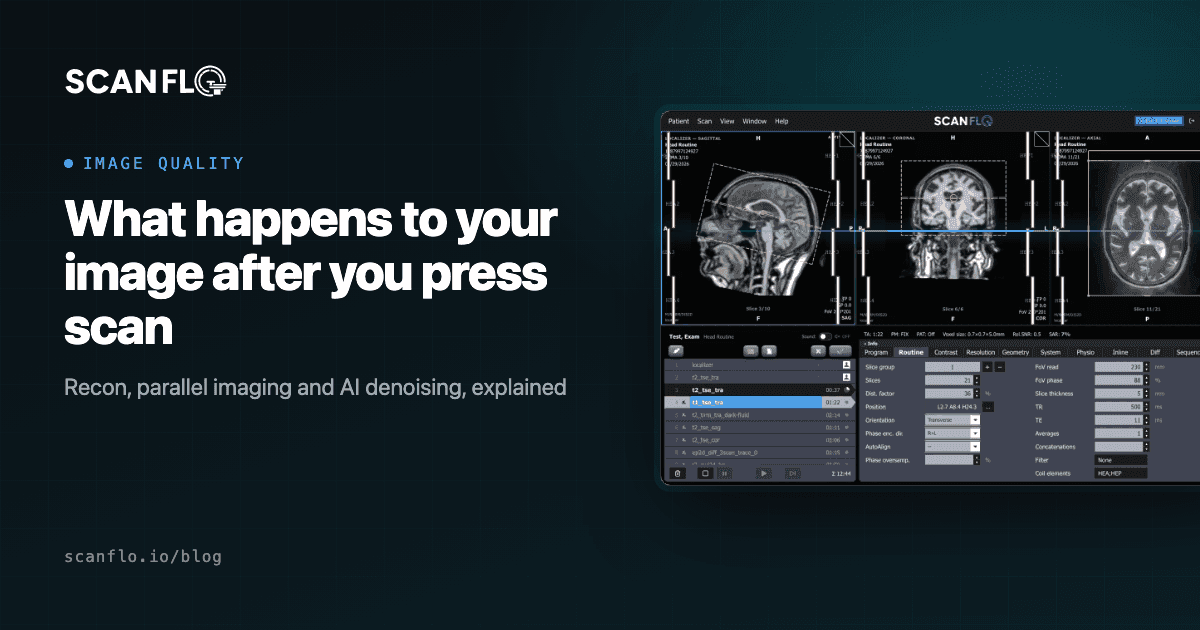 ScanFlo MRI console beside the title 'What happens to your image after you press scan'