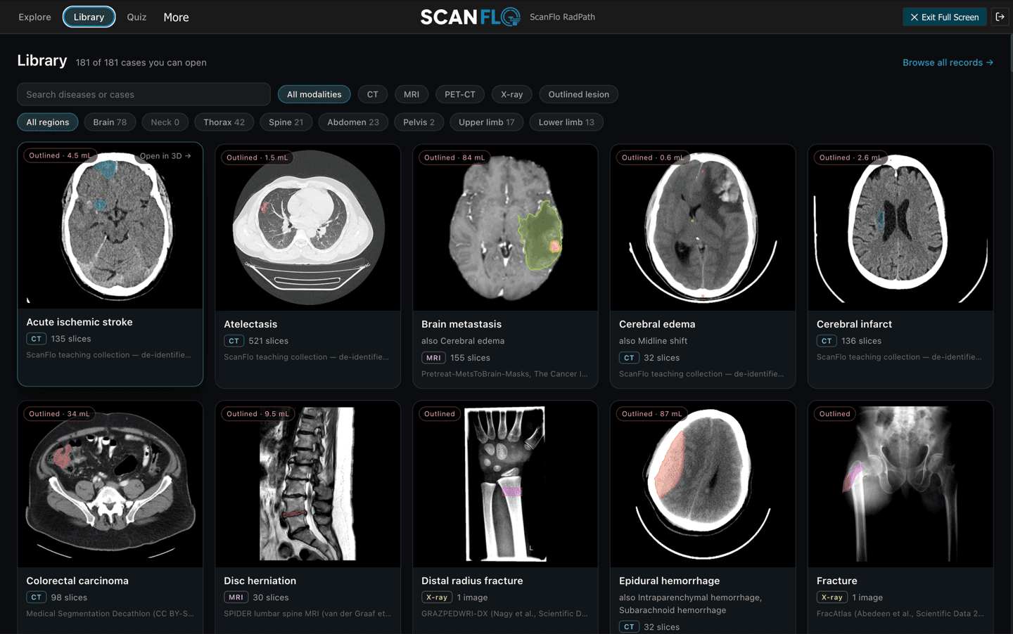 ScanFlo RadPath: the case library filtered by modality and region, showing CT, MRI and X-ray cases with outlined lesions