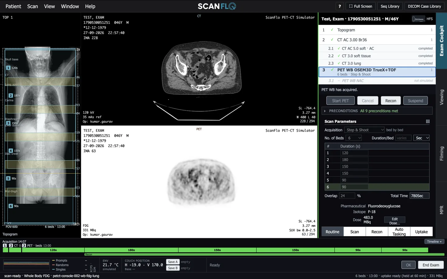 ScanFlo PET-CT exam screen. On the left, a whole-body topogram with six numbered PET bed positions from skull base to mid-thigh. In the middle, a CT slice and a PET slice of the pelvis. On the right, the exam list with topogram, CT for attenuation correction and whole-body PET, the bed durations, FDG as the pharmaceutical, the injected dose and a note that uptake is held at 60 minutes.