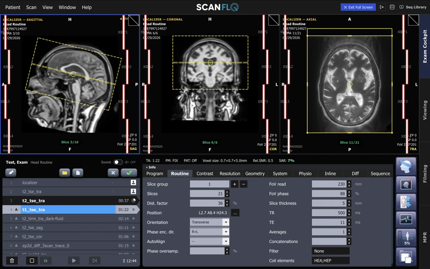 ScanFlo MRI console with head localizers and a protocol list, the routine parameter card open showing slices, field of view, TR, TE and phase encoding direction.