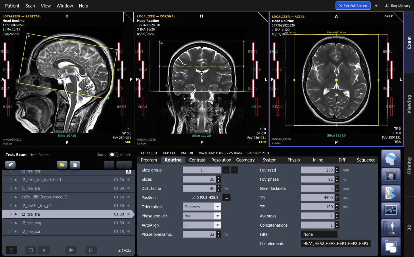 ScanFlo MRI exam console with sagittal, coronal and axial head localizers, a planned slice group, the protocol list and the parameter card showing TR, TE and slice thickness.