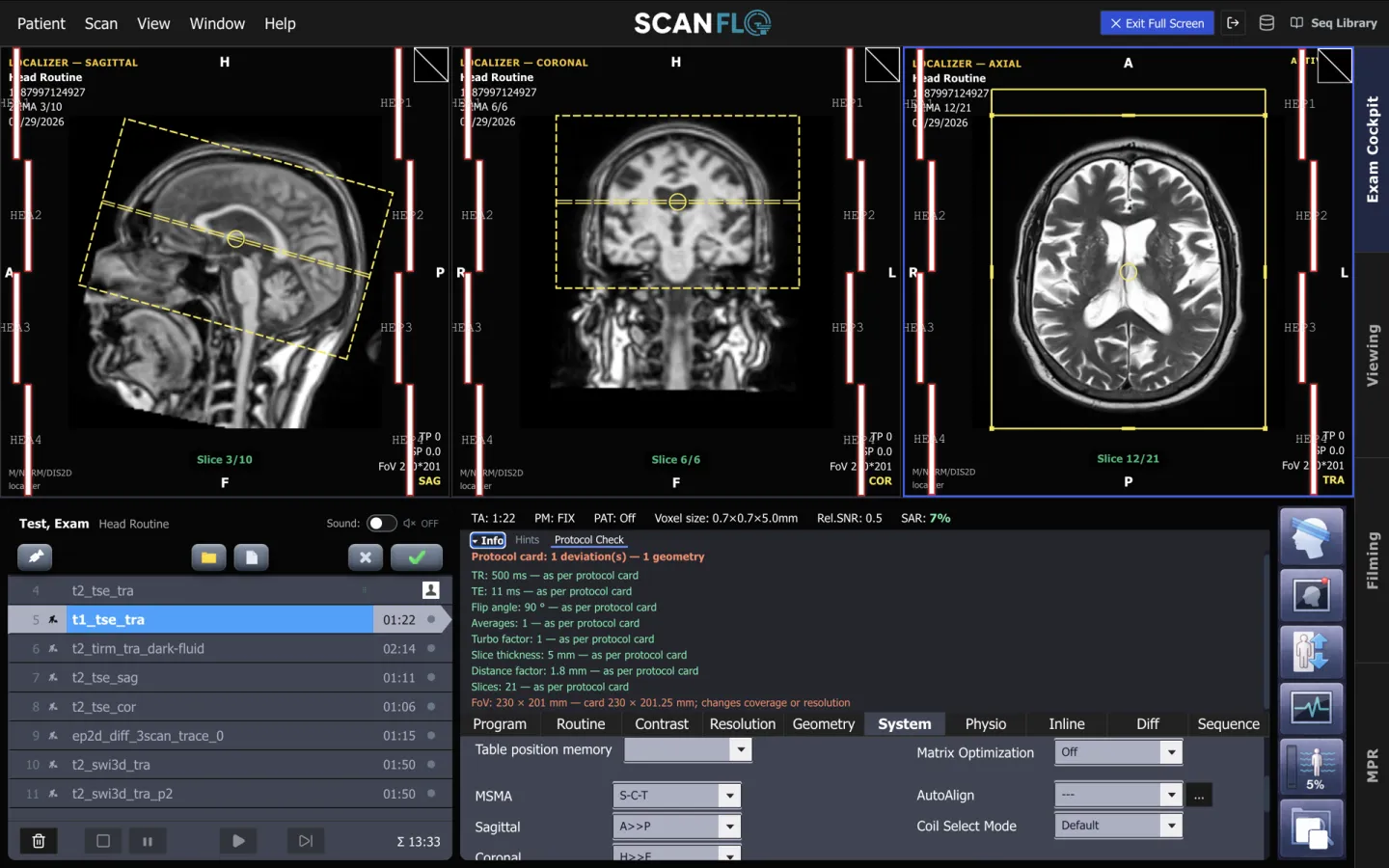 ScanFlo MRI Protocol Check panel listing TR, TE, flip angle, averages, turbo factor, slice thickness, distance factor and slices as matching the protocol card, and flagging one geometry deviation in the field of view.