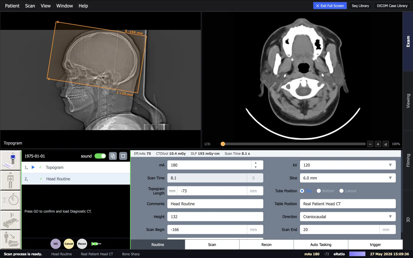 ScanFlo CT exam cockpit with a lateral head topogram and the planned scan range, an axial preview, and the protocol card showing mA, kV and slice thickness beside live CTDIvol and DLP.